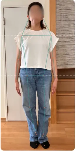 正面から撮影した姿勢写真に分析用のラインを重ねた例