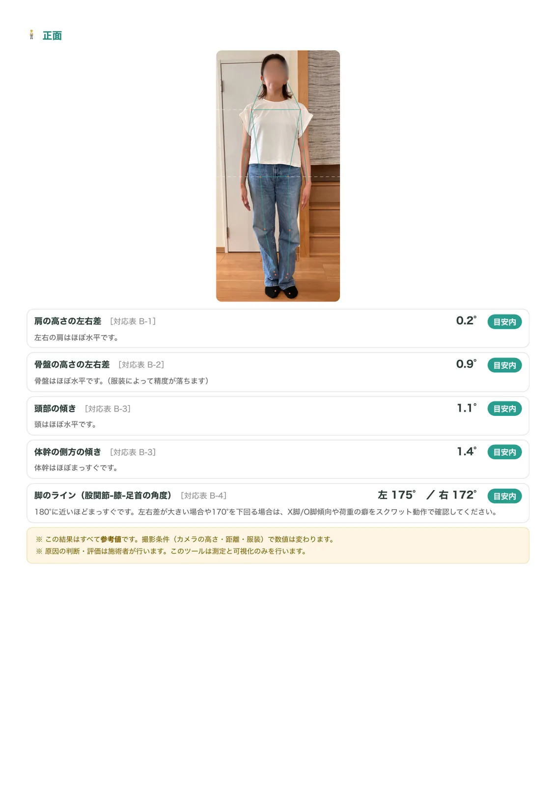 正面から撮影した姿勢分析レポートの例
