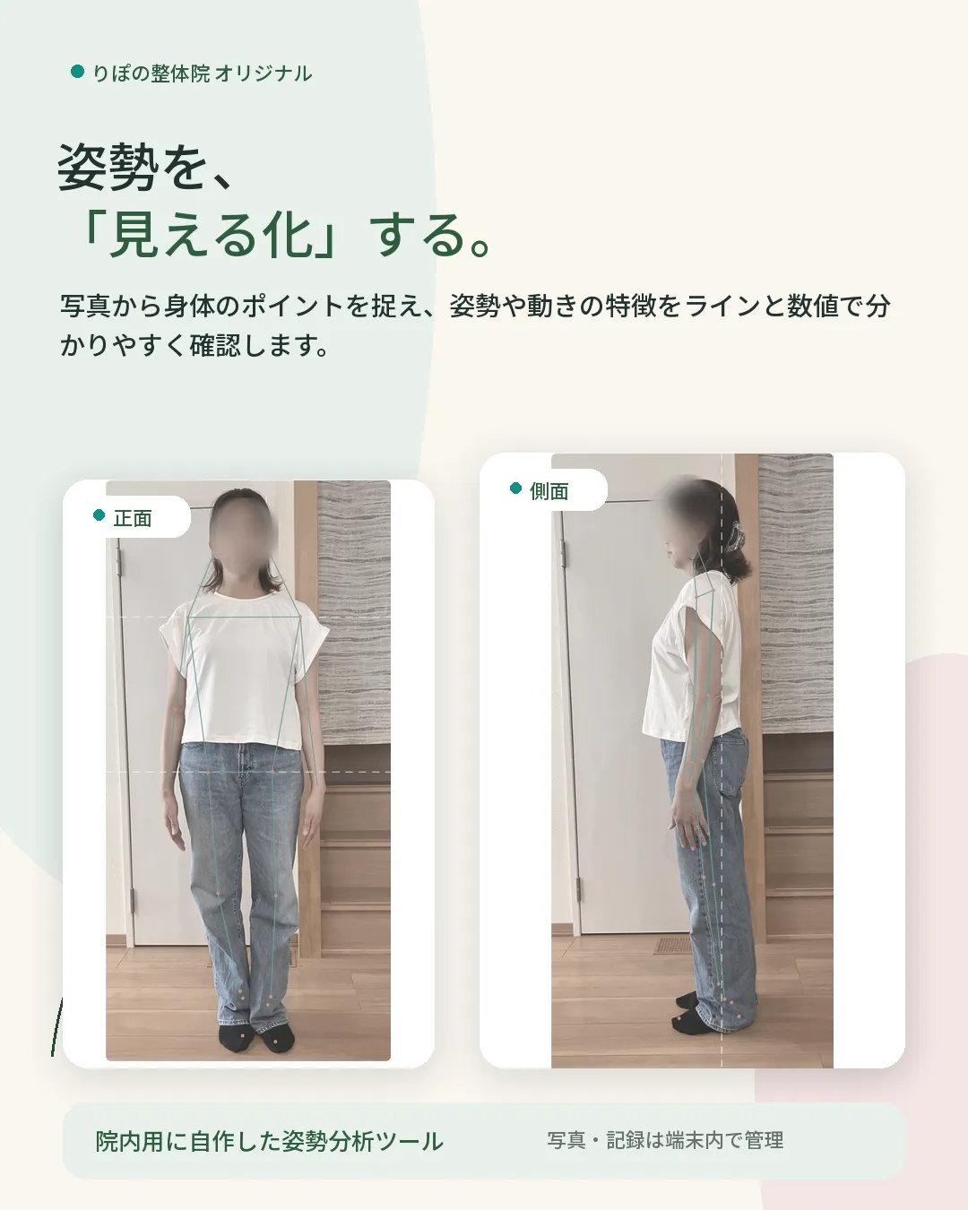 姿勢を写真で測定し、からだの傾向を線で見える化した例